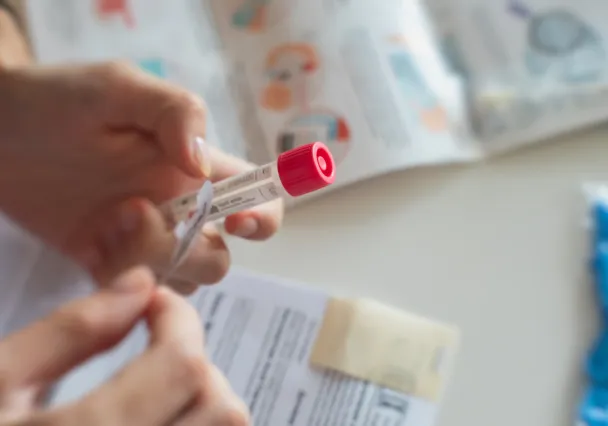 Mains tenant un tube de prélèvement étiqueté au-dessus d’un formulaire